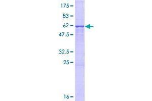 Image no. 1 for UTP15, U3 Small Nucleolar Ribonucleoprotein, Homolog (UTP15) (AA 1-285) protein (GST tag) (ABIN1324860)