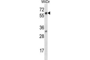 Western Blotting (WB) image for anti-La Ribonucleoprotein Domain Family, Member 7 (LARP7) antibody (ABIN2997066) (LARP7 anticorps)