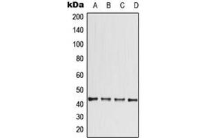 Western blot analysis of CCBE1 expression in ACHN (A), HeLa (B), SP2/0 (C), PC12 (D) whole cell lysates. (CCBE1 anticorps  (Center))