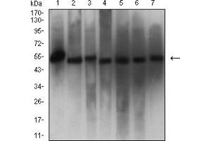 Western blot analysis using CALR mouse mAb against Hela (1), MCF-7 (2), NIH/3T3 (3), HepG2 (4), Jurkat (5), Y-79 (6), and C6 (7) cell lysate.