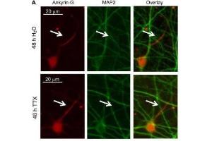 Cultured rat hippocampal neurons (DIV 11-12) were treated for 48 h with 1 μM TTX or its vehicle control (0. (Ankyrin G anticorps)