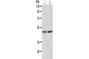 Western Blotting (WB) image for anti-Alanine Glyoxylate Aminotransferase (AGXT) antibody (ABIN2426537) (AGXT anticorps)