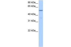 Western Blotting (WB) image for anti-Choline Kinase alpha (CHKA) antibody (ABIN2463572) (Choline Kinase alpha anticorps)