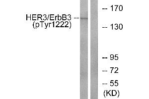 Western blot analysis of extracts from HUVEC cells, treated with EGF (200ng/ml, 30mins), using HER3/ErbB3 (Phospho-Tyr1222) antibody. (ERBB3 anticorps  (pTyr1222))