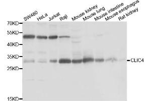 Western blot analysis of extracts of various cell lines, using CLIC4 antibody (ABIN5974262) at 1/1000 dilution. (CLIC4 anticorps)