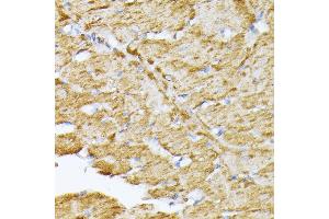 Immunohistochemistry of paraffin-embedded rat heart using SLC25 antibody (ABIN7270430) at dilution of 1:100 (40x lens).