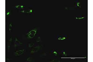 Immunofluorescence of purified MaxPab antibody to PYCR2 on HeLa cell.