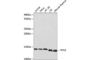 Western blot analysis of extracts of various cell lines using PFN1 Polyclonal Antibody at dilution of 1:500. (PFN1 anticorps)