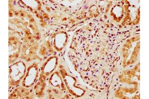 IHC image of ABIN7175958 diluted at 1:300 and staining in paraffin-embedded human kidney tissue performed on a Leica BondTM system.