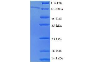 SDS-PAGE (SDS) image for Epoxide Hydrolase 1, Microsomal (Xenobiotic) (EPHX1) (AA 1-455), (full length) protein (His-SUMO Tag) (ABIN5709473) (EPHX1 Protein (AA 1-455, full length) (His-SUMO Tag))