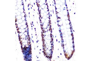 Immunohistochemistry of paraffin-embedded human colon using SRSF1/SRSF1/SF2/ASF Rabbit mAb (ABIN7270213) at dilution of 1:100 (40x lens). (SRSF1 anticorps)