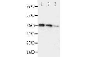 Lane 3: Recombinant Human DDR2 Protein 2. (DDR2 anticorps  (C-Term))