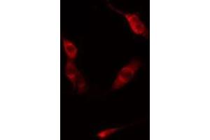 ABIN6275854 staining  Hela cells by IF/ICC.