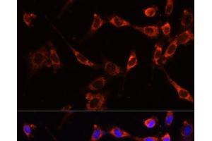 Immunofluorescence analysis of NIH-3T3 cells using PTPN13 Polyclonal Antibody at dilution of 1:100 (40x lens). (PTPN13 anticorps)