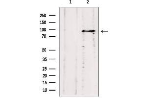 Western blot analysis of extracts from HepG2, using ODF2 antibody.