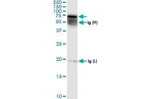 Immunoprecipitation of GALNS transfected lysate using anti-GALNS MaxPab rabbit polyclonal antibody and Protein A Magnetic Bead , and immunoblotted with GALNS MaxPab rabbit polyclonal antibody (D01) .