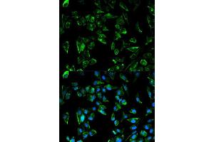 Immunofluorescence analysis of HeLa cell using TPM3 antibody. (TPM3 anticorps  (AA 1-284))