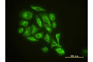 Immunofluorescence of monoclonal antibody to GMFB on HeLa cell. (GMFB anticorps  (AA 1-154))