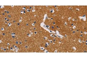 Immunohistochemistry of paraffin-embedded Human brain using GPM6A Polyclonal Antibody at dilution of 1:40 (GPM6A anticorps)
