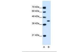 Image no. 2 for anti-Glutamic-Oxaloacetic Transaminase 2, Mitochondrial (Aspartate Aminotransferase 2) (GOT2) (AA 329-378) antibody (ABIN320796) (GOT2 anticorps  (AA 329-378))
