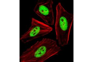Fluorescent image of HeLa cells stained with Phospho-CDC25A Antibody A. (CDC25A anticorps  (pThr507))