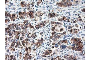 Image no. 5 for anti-Ribophorin 1 (RPN1) antibody (ABIN1500749)