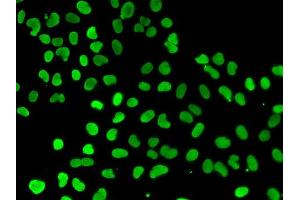 Immunofluorescence analysis of A549 cell using DNMT3L antibody. (DNMT3L anticorps)