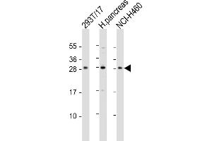 All lanes : Anti-COMTD1 Antibody (C-term) at 1:1000 dilution Lane 1: 293T/17 whole cell lysate Lane 2: human pancreas lysate Lane 3: NCI- whole cell lysate Lysates/proteins at 20 μg per lane. (COMTD1 anticorps  (C-Term))