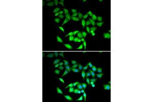 Immunofluorescence analysis of U2OS cells using CCT3 antibody.