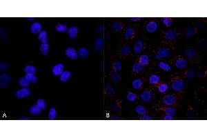 Immunocytochemistry/Immunofluorescence analysis using Mouse Anti-VPS35 Monoclonal Antibody, Clone 8A3 (ABIN6932966). (VPS35 anticorps  (APC))
