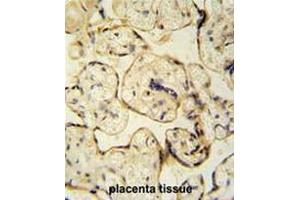 CLIC6 antibody (Center) immunohistochemistry analysis in formalin fixed and paraffin embedded human placenta tissue tissue followed by peroxidase conjugation of the secondary antibody and DAB staining. (CLIC6 anticorps  (Middle Region))
