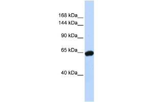 WB Suggested Anti-ZNF91 Antibody Titration:  0. (ZFP91 anticorps  (N-Term))