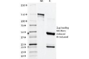 SDS-PAGE Analysis Purified PSAP Mouse Monoclonal Antibody (ACPP/1339). (ACPP anticorps)