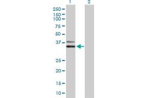 Western Blot analysis of PCGF6 expression in transfected 293T cell line by PCGF6 MaxPab polyclonal antibody. (PCGF6 anticorps  (AA 1-277))
