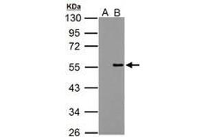 Image no. 1 for anti-Protein Phosphatase 4, Regulatory Subunit 2 (PPP4R2) (AA 1-360) antibody (ABIN1500387) (PPP4R2 anticorps  (AA 1-360))