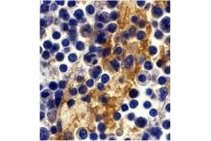 Immunohistochemistry (IHC) image for anti-CD209 (CD209) (C-Term) antibody (ABIN1030357) (DC-SIGN/CD209 anticorps  (C-Term))