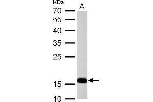 WB Image Stathmin 1 antibody detects STMN1 protein by Western blot analysis.