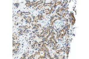 IHC analysis of RASAL1 using anti-RASAL1 antibody (ABIN6719367). (RASAL1 anticorps  (AA 721-798))