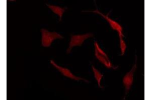 ABIN6275331 staining Hela by IF/ICC.