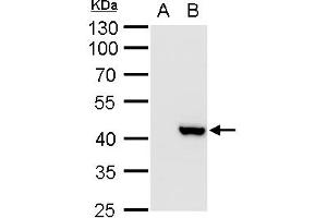 WB Image XRCC3 antibody detects XRCC3 protein by western blot analysis.