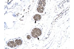 MMP19 antibody was used for immunohistochemistry at a concentration of 4-8 ug/ml to stain Ganglionic cells (arrows) in Human urinary bladder. (MMP19 anticorps  (N-Term))
