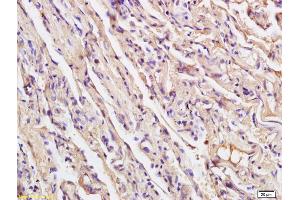 Formalin-fixed and paraffin embedded human endometrial tissue labeled with Anti XRCC4 Polyclonal Antibody, Unconjugated (ABIN1386856) at 1:200 followed by conjugation to the secondary antibody and DAB staining
