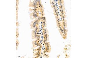 Immunohistochemistry of paraffin embedded mouse duodenum using GDPD2 (ABIN7074098) at dilution of 1:650 (400x lens) (GDPD2 anticorps)