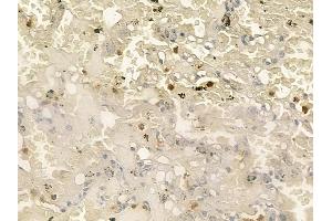 ABIN6258621 and ABIN6273442 at 1/100 staining human normal lung tissue by IHC-P.