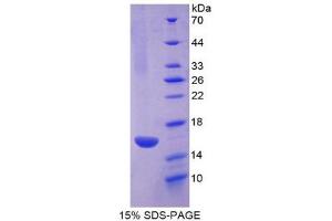 SDS-PAGE (SDS) image for R-Spondin 1 (RSPO1) (AA 21-135) protein (His tag) (ABIN1878605)