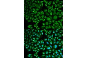 Immunofluorescence analysis of MCF-7 cells using CTSA antibody (ABIN5973211). (CTSA anticorps)