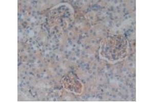 Detection of CFH in Rat Kidney Tissue using Polyclonal Antibody to Complement Factor H (CFH)