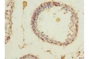 Immunohistochemistry of paraffin-embedded human testis tissue using ABIN7176048 at dilution of 1:100