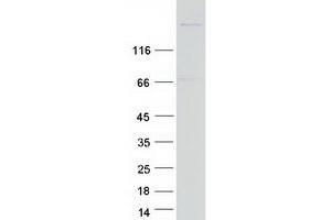 Validation with Western Blot