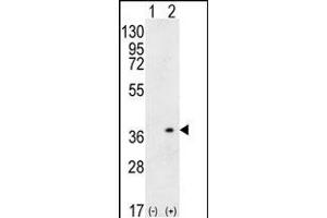 Western blot analysis of HLA-DQA1 (arrow) using rabbit polyclonal HLA-DQA1 Antibody (N-term) (ABIN656108 and ABIN2837859). (HLA-DQA1 anticorps  (N-Term))